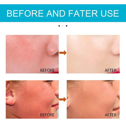 Soléri™ – Hydraterende Zonnebrandstick SPF 50+