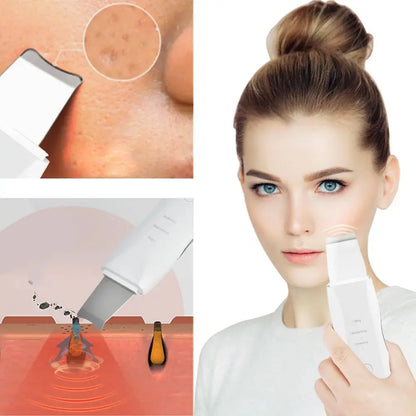 PuraGlow™ – Diep Reinigende Vibrerende Skin Scrubber & Gezichtsmassager