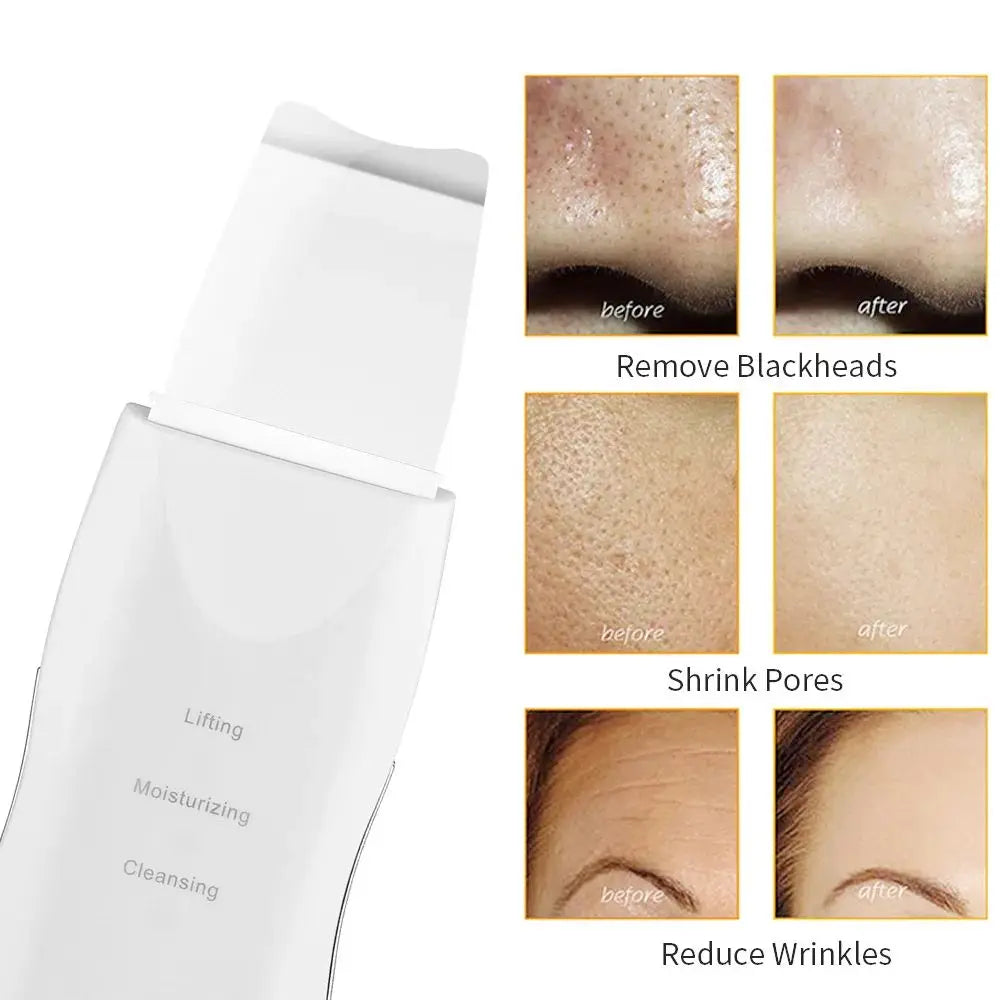 PuraGlow™ – Diep Reinigende Vibrerende Skin Scrubber & Gezichtsmassager