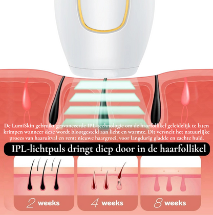 LumiSkin™ IPL Ontharingslaser – Pijnloze thuisbehandeling voor een zijdezachte huid